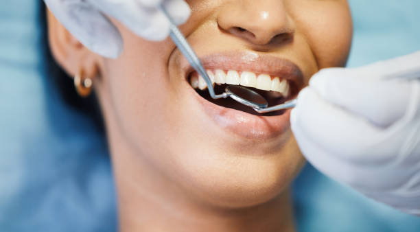 Best Emergency Treatment for Dental Infections or Abscesses in West Hempstead, NY