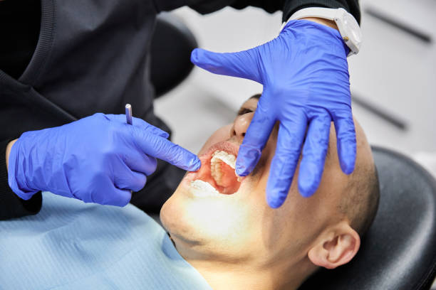 Best Emergency Dental Care for Broken or Chipped Teeth in West Hempstead, NY